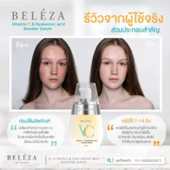 [ของแท้ ส่งไว] Beleza VC เบเลซ่า วีซี รอยสิวจางลง ผิวกระจ่างใสขึ้น วิตามินซี ไฮยาลูรอน (1)